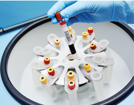 Medical laboratory centrifuge with test tubes with blood