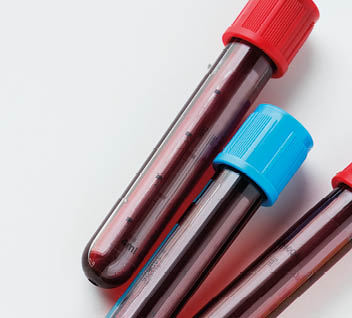 Closeup of blood tube test