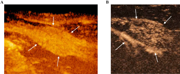 Spada S, De Felice D, Arlt S, Aires LPN, England GCW and Russo M (2025) Long-term ultrasonographic changes of the canine prostate gland after castration. Front. Vet. Sci. 11:1524896. doi: 10.3389/fvets.2024.1524896