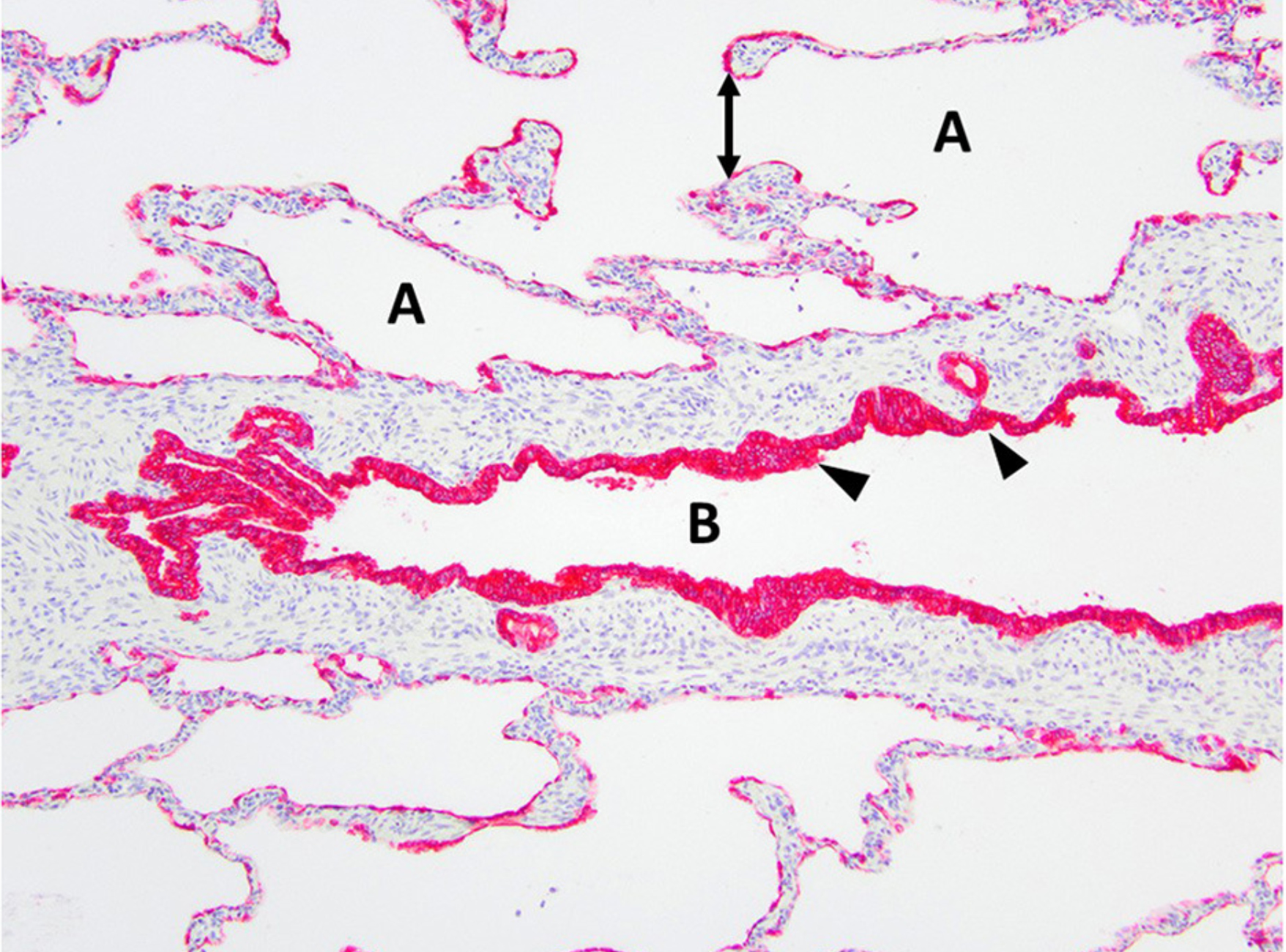 Edwards LM, Lux CN, Everett M and Hecht S (2023) Case report: Treatment of congenital lobar emphysema with lung lobectomy in a puppy. Front. Vet. Sci. 10:1083376. doi: 10.3389/fvets.2023.1083376