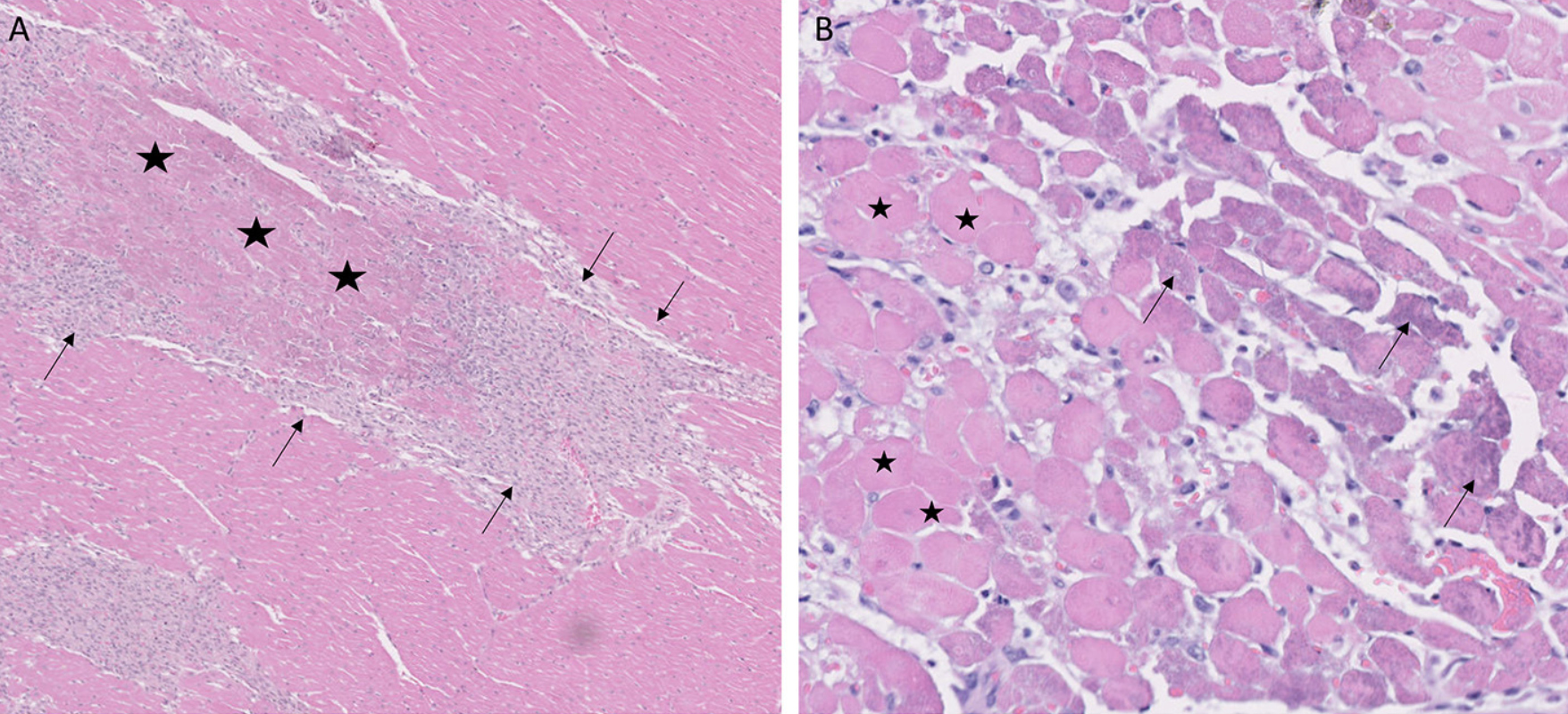 Background: Duchenne muscular dystrophy (DMD) is an X-linked inherited myopathy that causes progressive skeletal and cardiac muscle disease.
